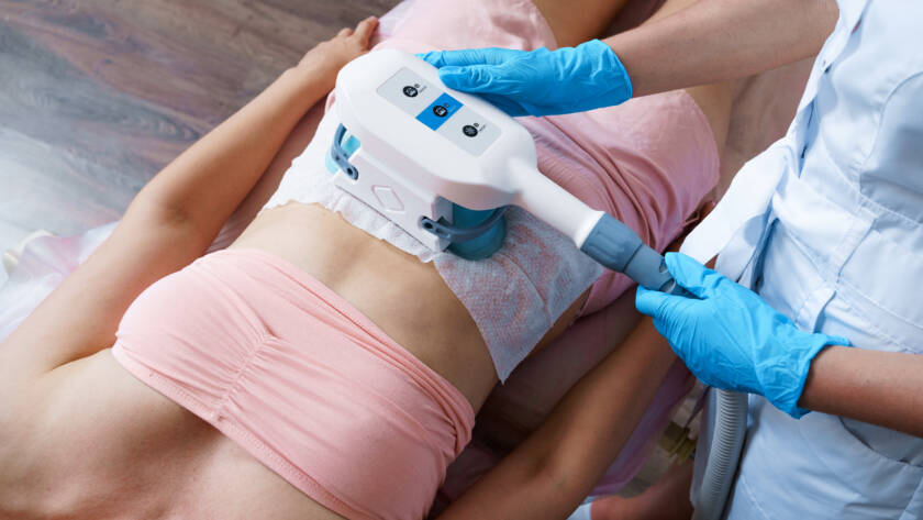 Coolsculpting Body Fat Removal Session Corpus Christi